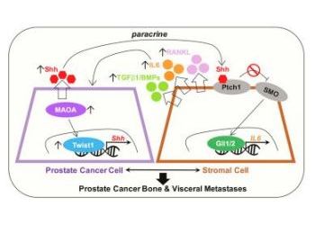 WSU Spokane researcher advances prostate cancer research